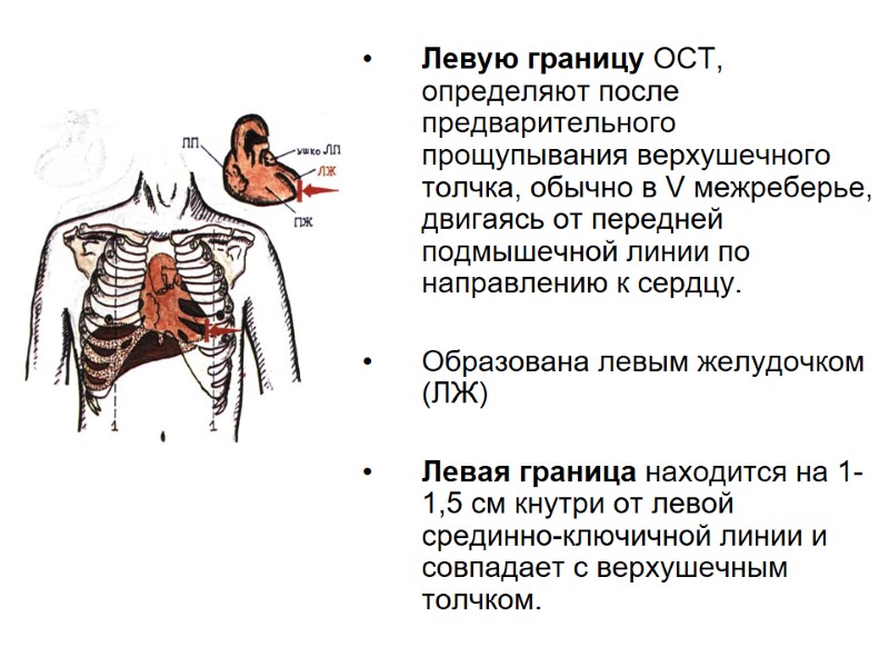 Левую границу ОСТ, определяют после предварительного прощупывания верхушечного толчка, обычно в V межреберье, двигаясь